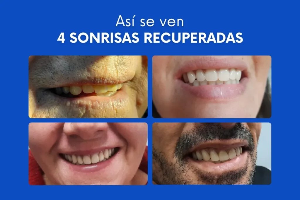 Así se ven: 4 sonrisas recuperadas en Centro Dental Pando